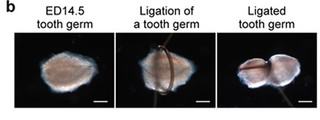 Illustration for article titled We're One Step Closer to Being Able to Regrow a Lost Tooth